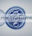 美国试管婴儿促排过程需要知道的四件事