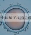 在国外申请精子库精子做试管婴儿需要满足什么条件？