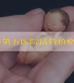 上饶市第五医院试管价格表出炉！附2024年试管婴儿医院辅助生殖费用明细