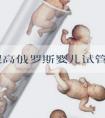 想要提高俄罗斯婴儿试管成功率,这样吃最关键!