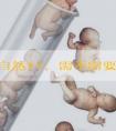有1次自然**，需不需要找原因、做治疗?