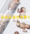 多囊卵巢做美国试管婴儿的成功案例