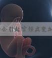 做试管会引起宫颈病变加重吗？