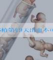 胚胎移植第49天出血不可大意,中医教你如何保胎