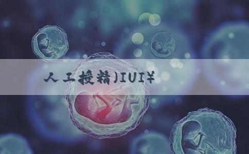 人工授精（IUI）