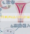 美国试管机构达100余家,优势、口碑大不同