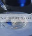 移植后5天冲洗阴道后对胚胎有没有影响？