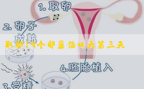取卵19个卵巢伤口大第三天别移植！身体好坏对成功率影响大