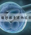 充分了解移植手术的过程，期待验孕棒上“红色双杠”的来临