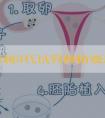 潍坊附属3代试管移植费用大概是多少？