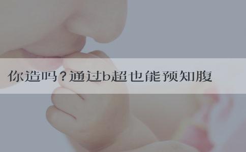 你造吗?通过b超也能预知腹中宝宝的性别