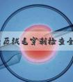 亲身经历绒毛穿刺检查全过程分享，预约挂号是第一步
