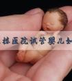 南京鼓楼医院试管婴儿如何_南京鼓楼医院试管费用大概多少钱啊！