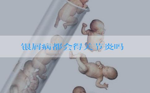 银屑病都会得关节炎吗