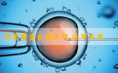 试管前查出有丙肝，还可以做试管婴儿吗？