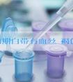 怀孕初期白带有血丝 褐色正常吗?